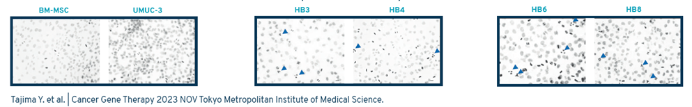 Human bone marrow-Metaphase chromosome spreads